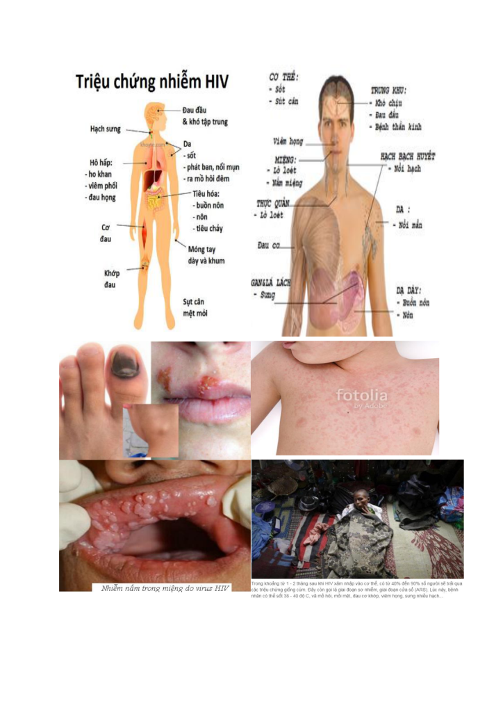 PrEP có hiệu quả và an toàn không? Những điều cần biết trước khi dùng – TOP ONE HIV